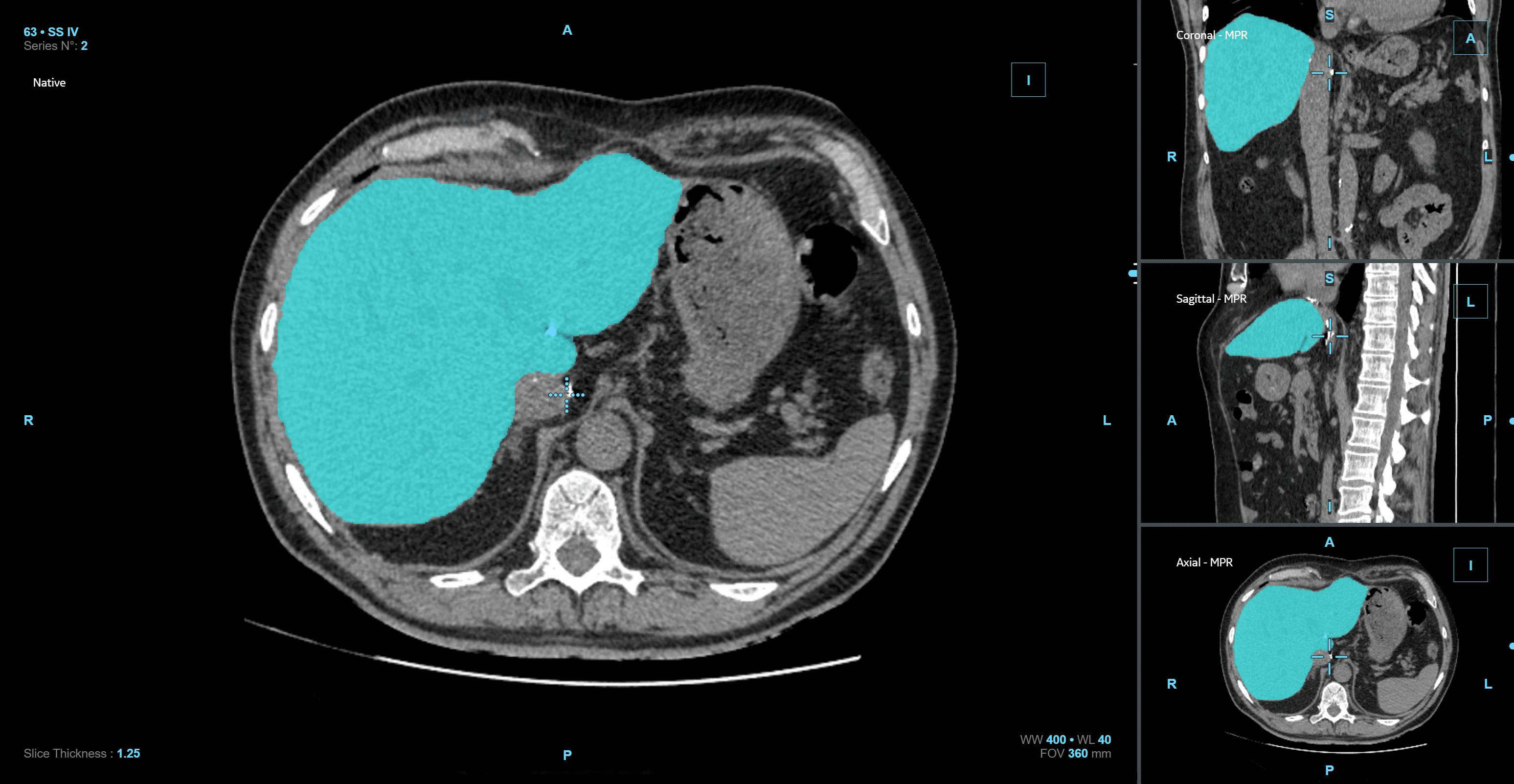 overview ct scanner section of the human body